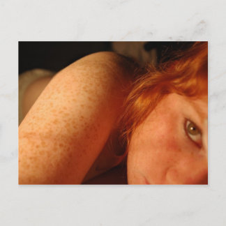 Freckles Postcard