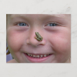 Frog On Nose Postcard
