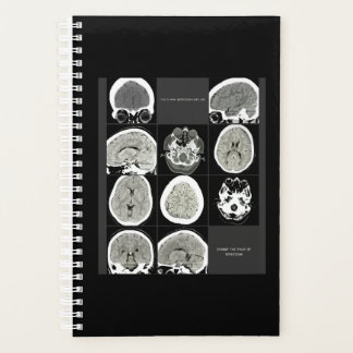 FullCTScan_thisiswhatdepressionlookslike Planner