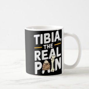 Funny Anatomy Going Tibia Okay Broken Leg Gift For Coffee Mug