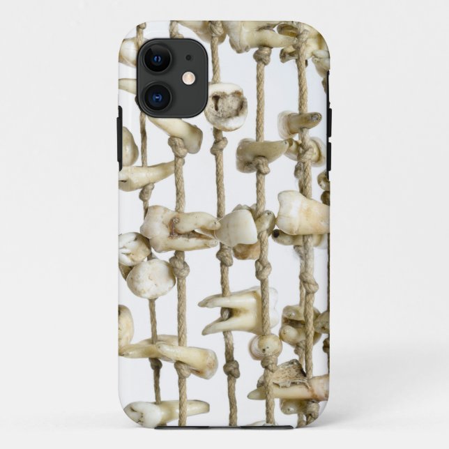 Funny Dental Photography Extracted Teeth Dentist Case-Mate iPhone Case (Back)