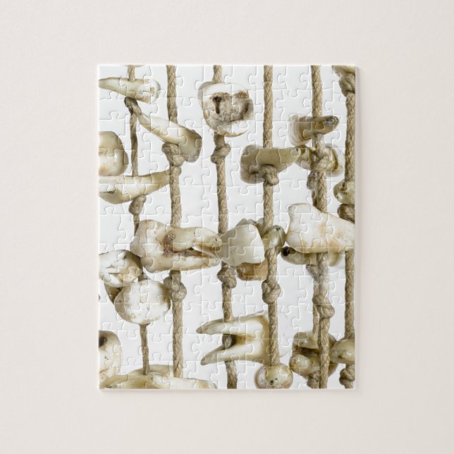 Funny Dental Photography Extracted Teeth Dentist Jigsaw Puzzle (Vertical)