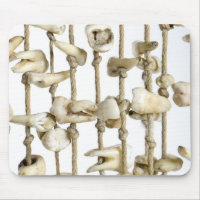 Funny Dental Photography Extracted Teeth Dentist