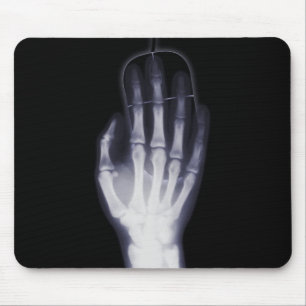 Funny Hand X-ray For internet addictioner Mouse Pad