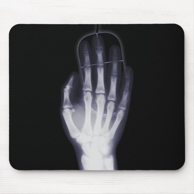 Funny Hand X-ray For internet addictioner Mouse Pad (Front)
