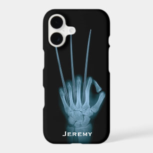 Funny Wolverine Blades Hand Xray
