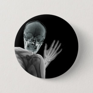 Funny Xray Photobomb 2 Inch Round Button