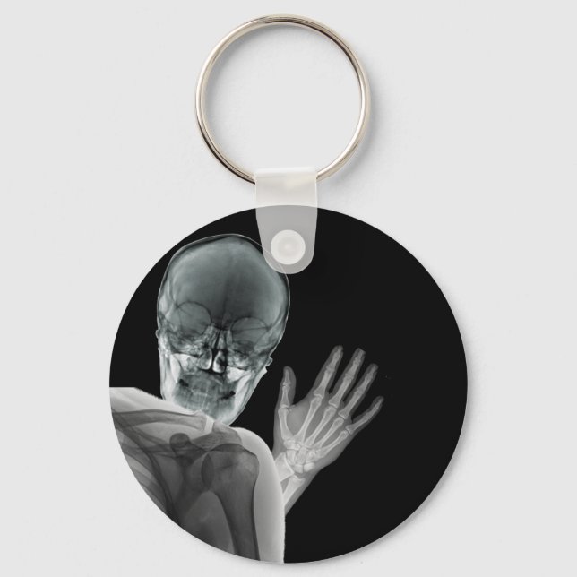 Funny Xray Photobomb Keychain (Front)