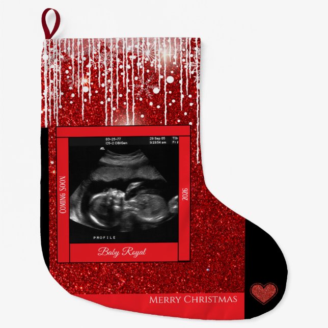 Grande Chaussette De Noël Joyeux Sonogramme de Noël bébé Bientôt (Devant)