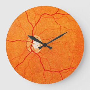 Grande Horloge Ronde Ophtalmologie Optométrie OEil Fundus Exode Mur Ho