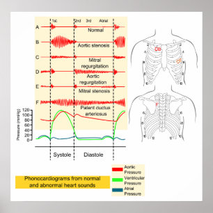 Graphically Recording of Heartbeat Sounds Diagram Poster
