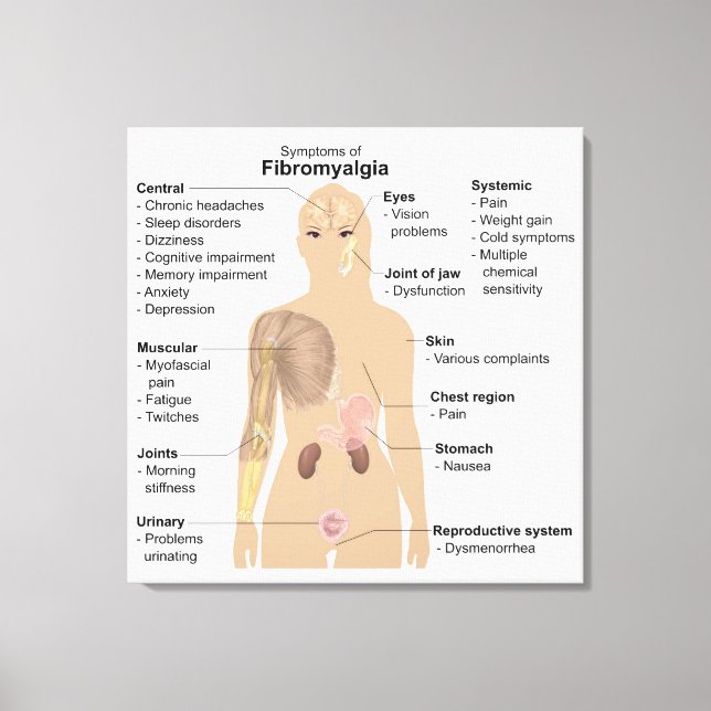 Graphique Signes Symptômes Fibromyalgie Impression (Recto)