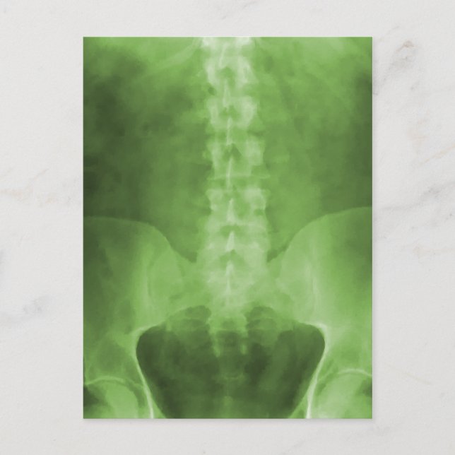Green Digital X-Ray Art Postcards (Front)