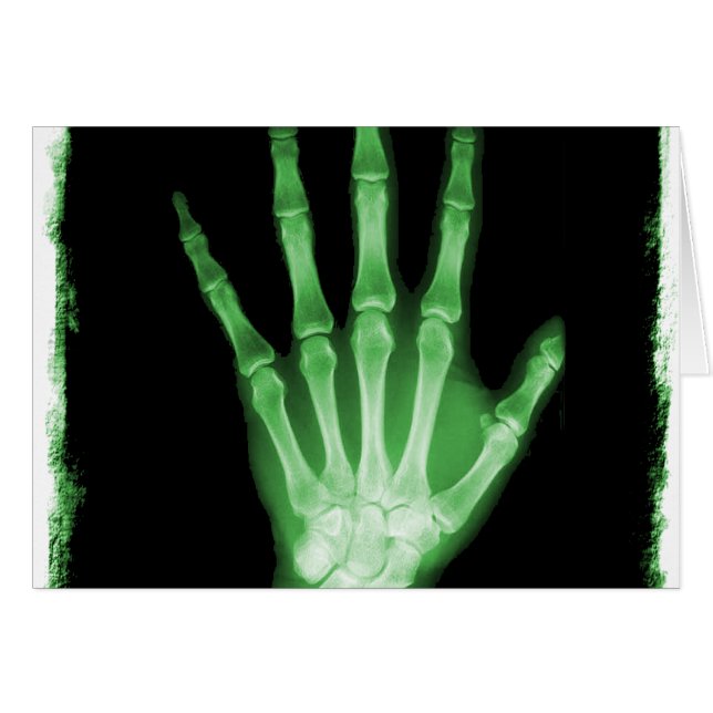 Green X-ray Skeleton Hand (Front Horizontal)