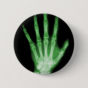 Green X-ray Skeleton Hand 2 Inch Round Button
