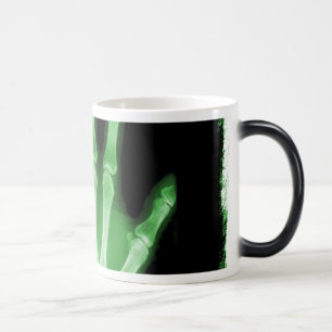 Green X-ray Skeleton Hand Magic Mug