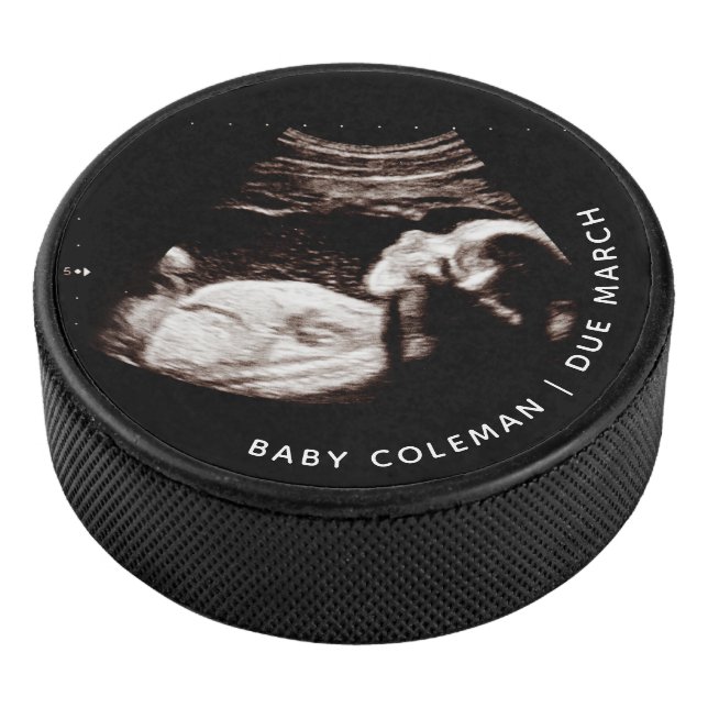 Grossesse Bébé Sonogramme Ultrasons Photo (3/4/2016 12:00:00 AM)