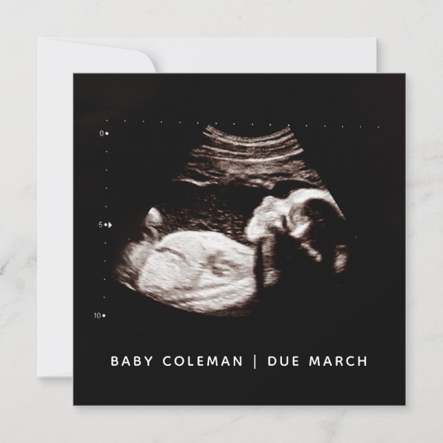 Grossesse Bébé Sonogramme Ultrasound Carte photo (Devant)