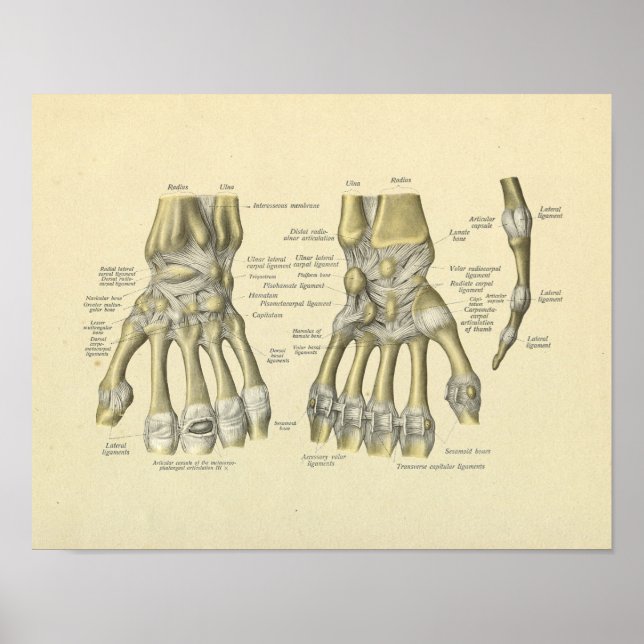 Hand Wrist Fingers Anatomy Bones Print (Front)