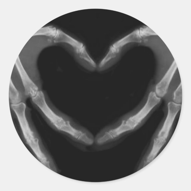 Hand X Ray Classic Round Sticker (Front)