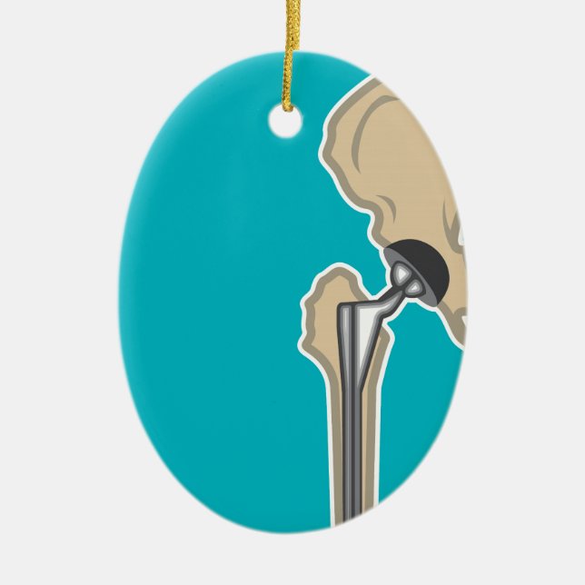Hip Joint Replacement Ceramic Ornament (Front)