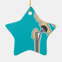 Hip Joint Replacement