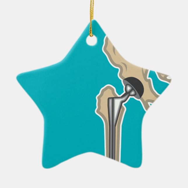 Hip Joint Replacement Ceramic Ornament (Front)