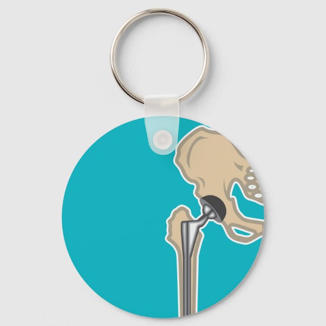 Hip Joint Replacement Keychain (Front)