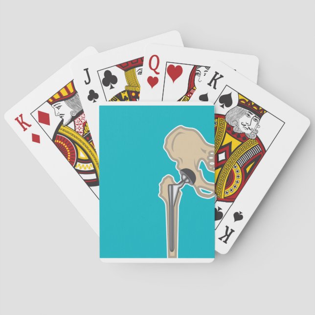 Hip Joint Replacement Playing Cards (Back)
