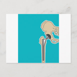 Hip Joint Replacement Postcard