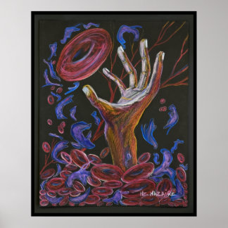 Hope - Sickle Cell Art Print