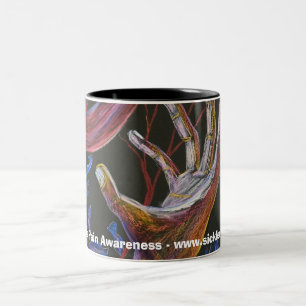 Hope - Sickle Cell Art Two-Tone Coffee Mug