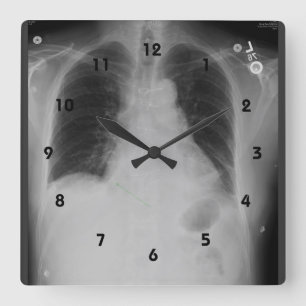 Horloge Carrée Chest X Ray