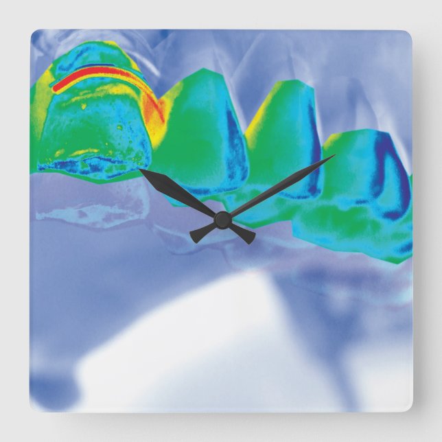 Horloge Carrée Original Teeth Design Dentist Wall Clock (Recto)