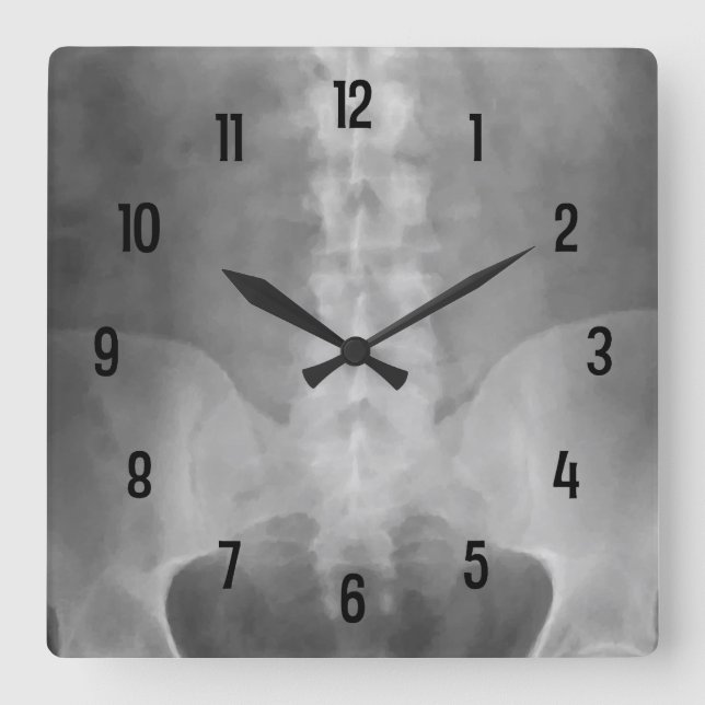 Horloge murale numérique X-Ray (Recto)