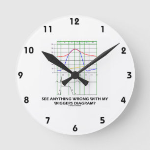 Horloge Ronde Voyez n'importe quoi mal avec mon diagramme de