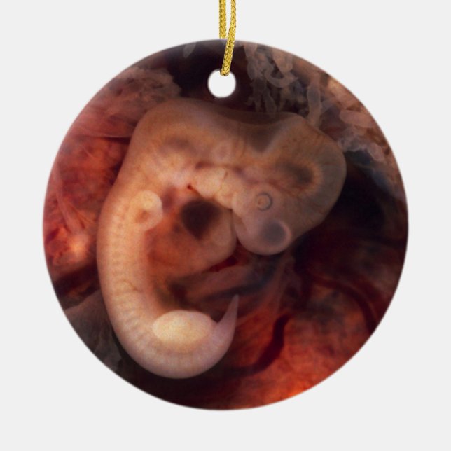 Human Embryo 7th Week of Pregnancy 5th Peek P.O. Ceramic Ornament (Front)