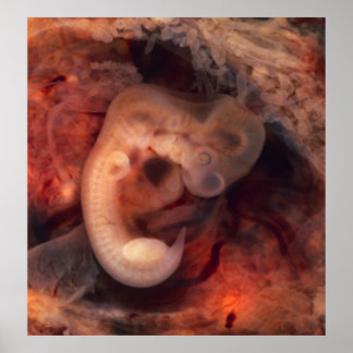 Human Embryo 7th Week of Pregnancy 5th Peek P.O. Poster