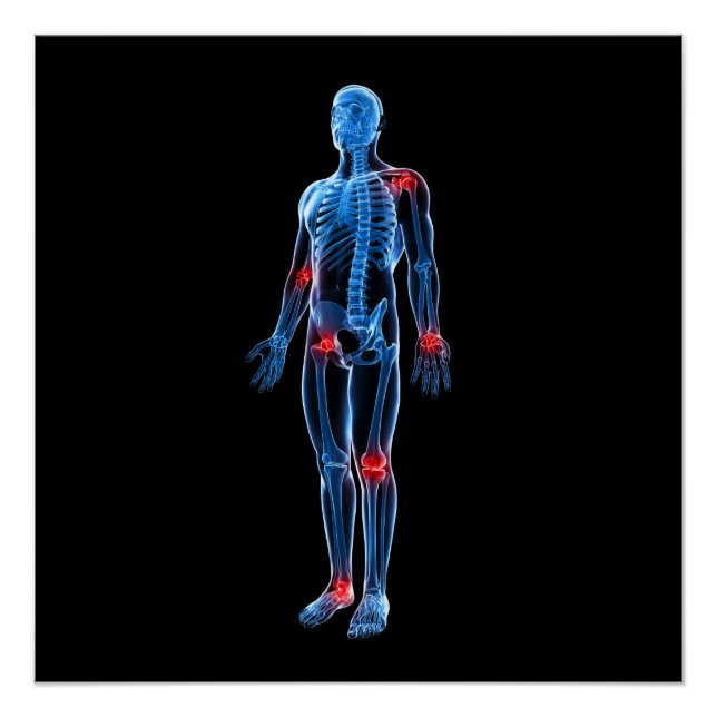 Human Xray Poster (Front)