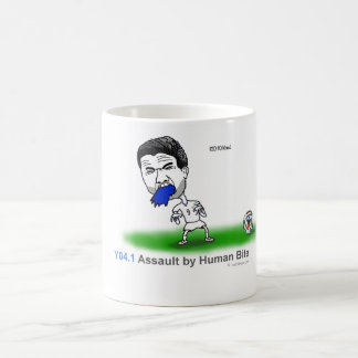 ICD-10: Y04.1 Assault by human bite Coffee Mug