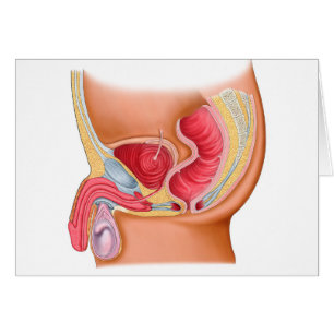 Illustration Médicale D'Une Fistule Rectouréthrale
