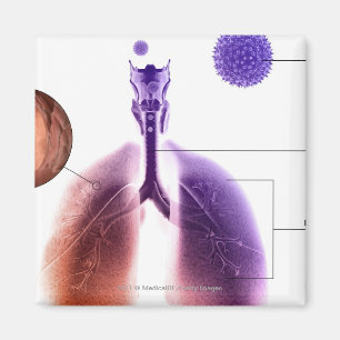 Illustration of an asthma attack from pollen magnet
