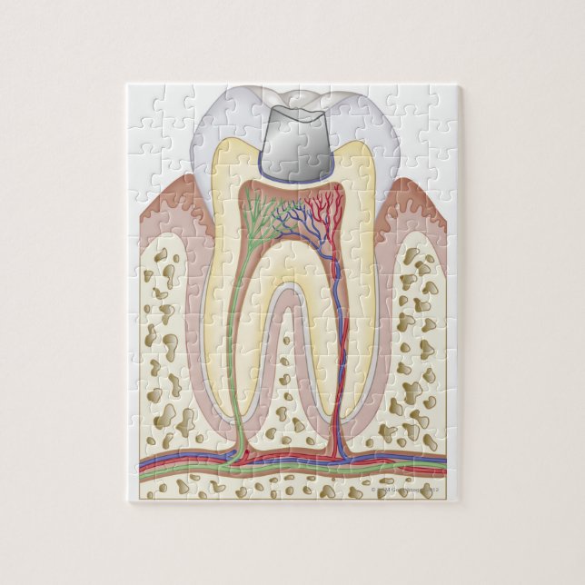 Illustration of Dental Filling Jigsaw Puzzle (Vertical)