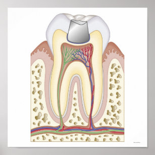 Illustration of Dental Filling Poster