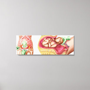 Illustration Showing Caesarean Delivery Of Fetus Canvas Print