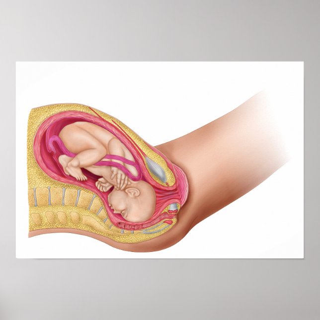 Illustration Showing Delivery Of Fetus 2 Poster (Front)