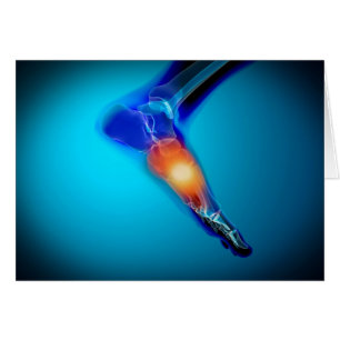 Image Conceptuelle De La Douleur Dans Le Pied Huma