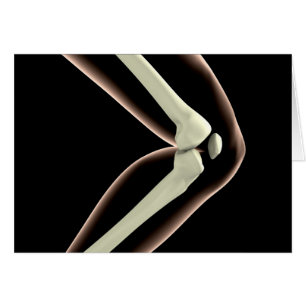 Image X-Ray Du Genou 1