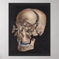 Impression du crâne éclaté désarticulé