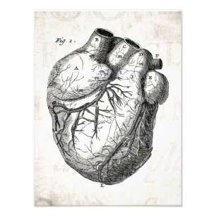 Impression Photo Rétros coeurs cardiaques d'anatomie de coeur